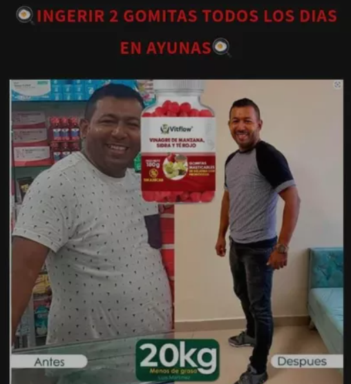 Vinagre de manzana en gomitas